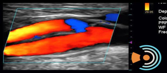 Doppler color - Rancagua