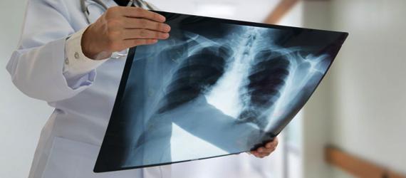 Radiografía en Rancagua